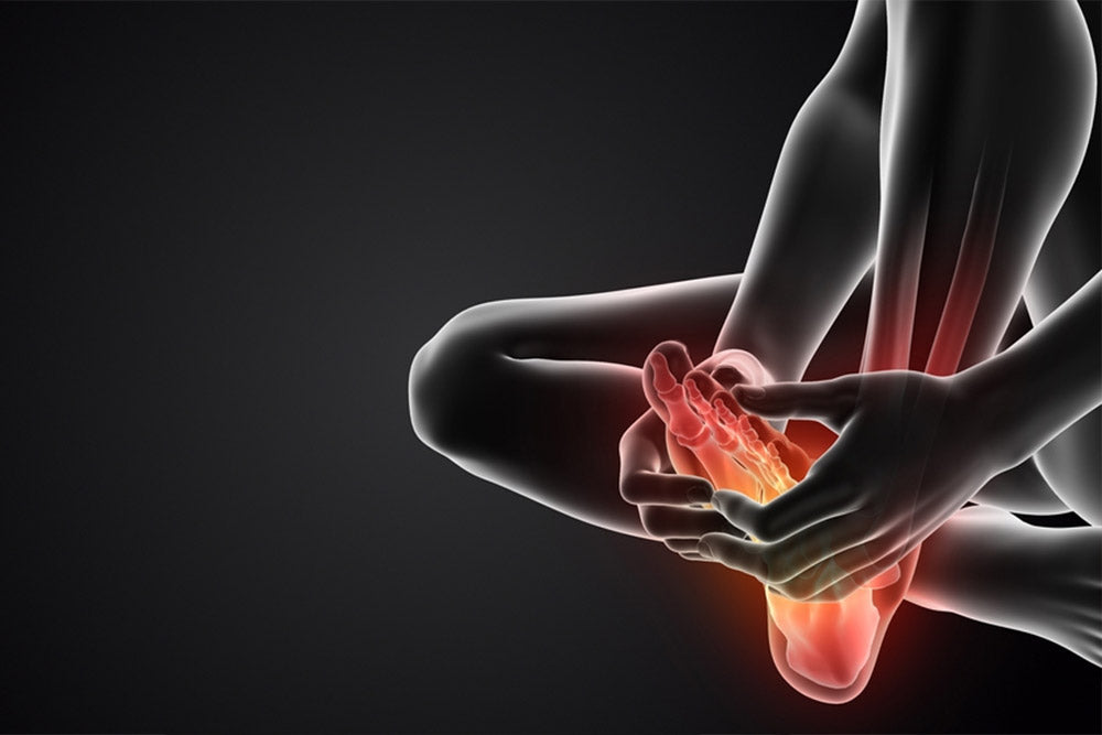 Comment soigner une épine calcanéenne naturellement ?