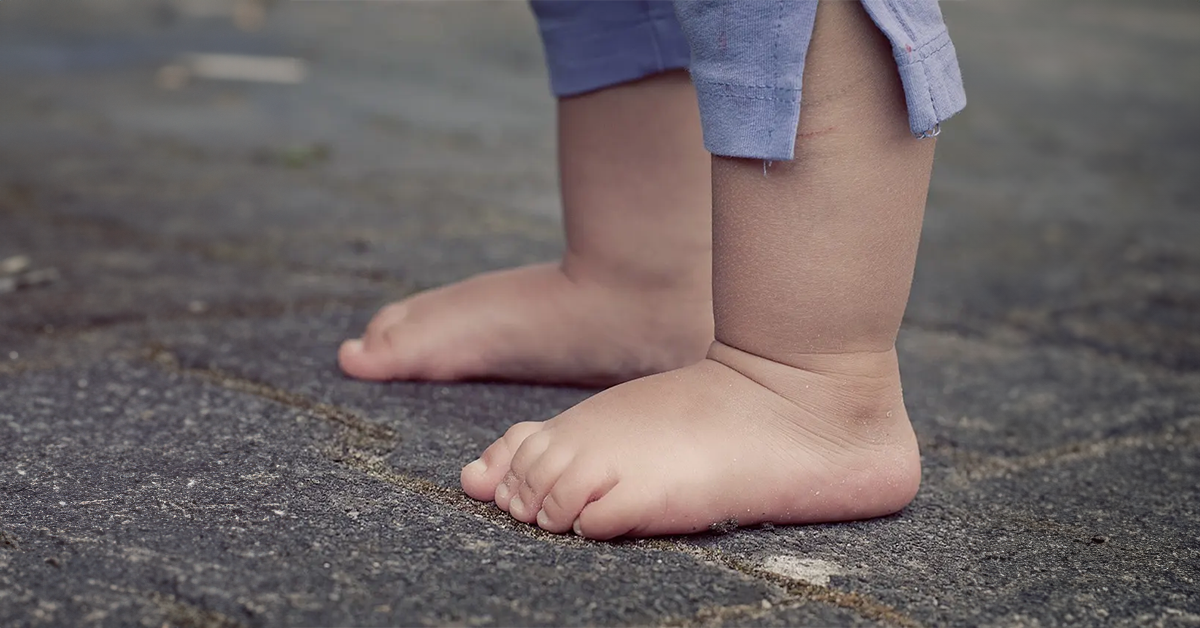 Pied Gonflé : Causes, Symptômes Distinctifs et Complications