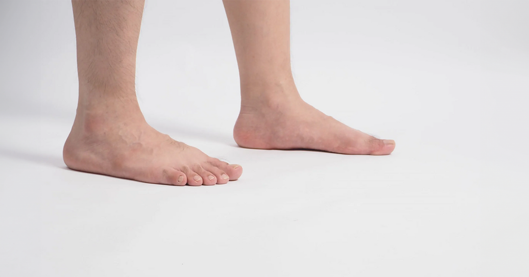 PIED PLAT : ORIGINES, CARACTÉRISTIQUES DISTINCTIVES ET COMPLICATIONS
