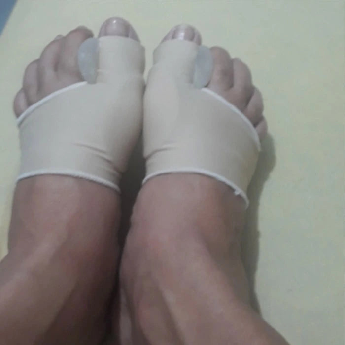 TRAITER NATURELLEMENT L'HALLUX VALGUS