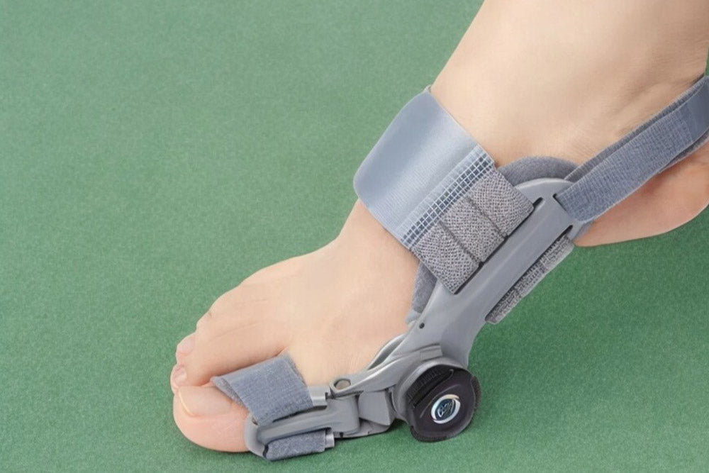 Pourquoi et comment protéger son hallux valgus ?