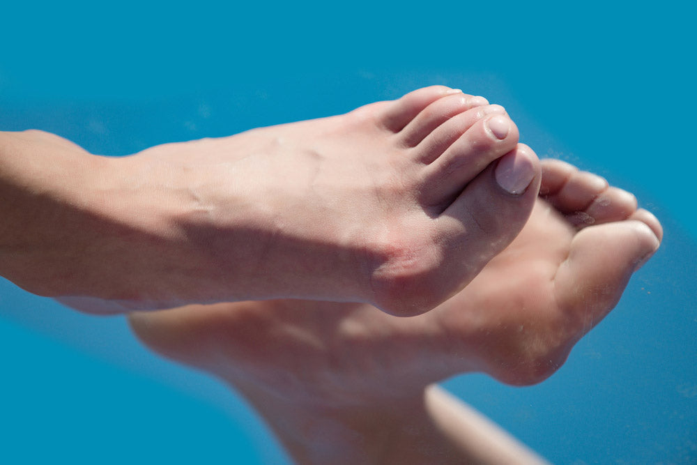 Comprendre quand se faire opérer de l'hallux valgus