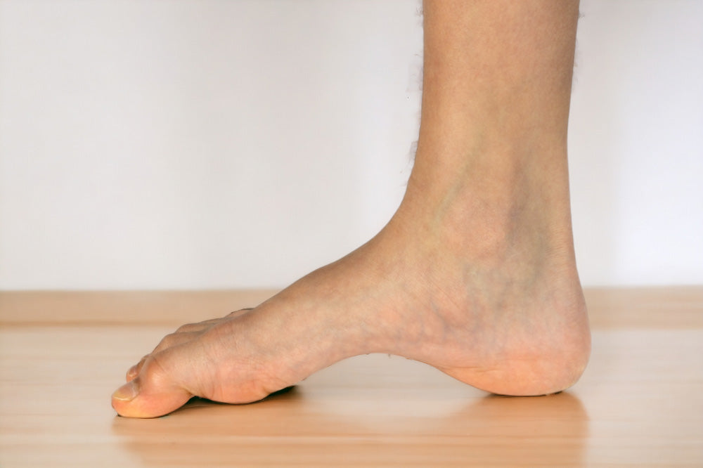Comprendre les bienfaits des semelles orthopédiques pour pieds creux