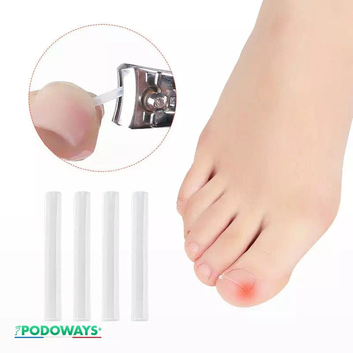 Accessoire de traitement des ongles incarnés Protège-orteils en Silicone Podoways   
