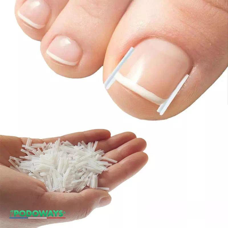 Accessoire de traitement des ongles incarnés Protège-orteils en Silicone Podoways   