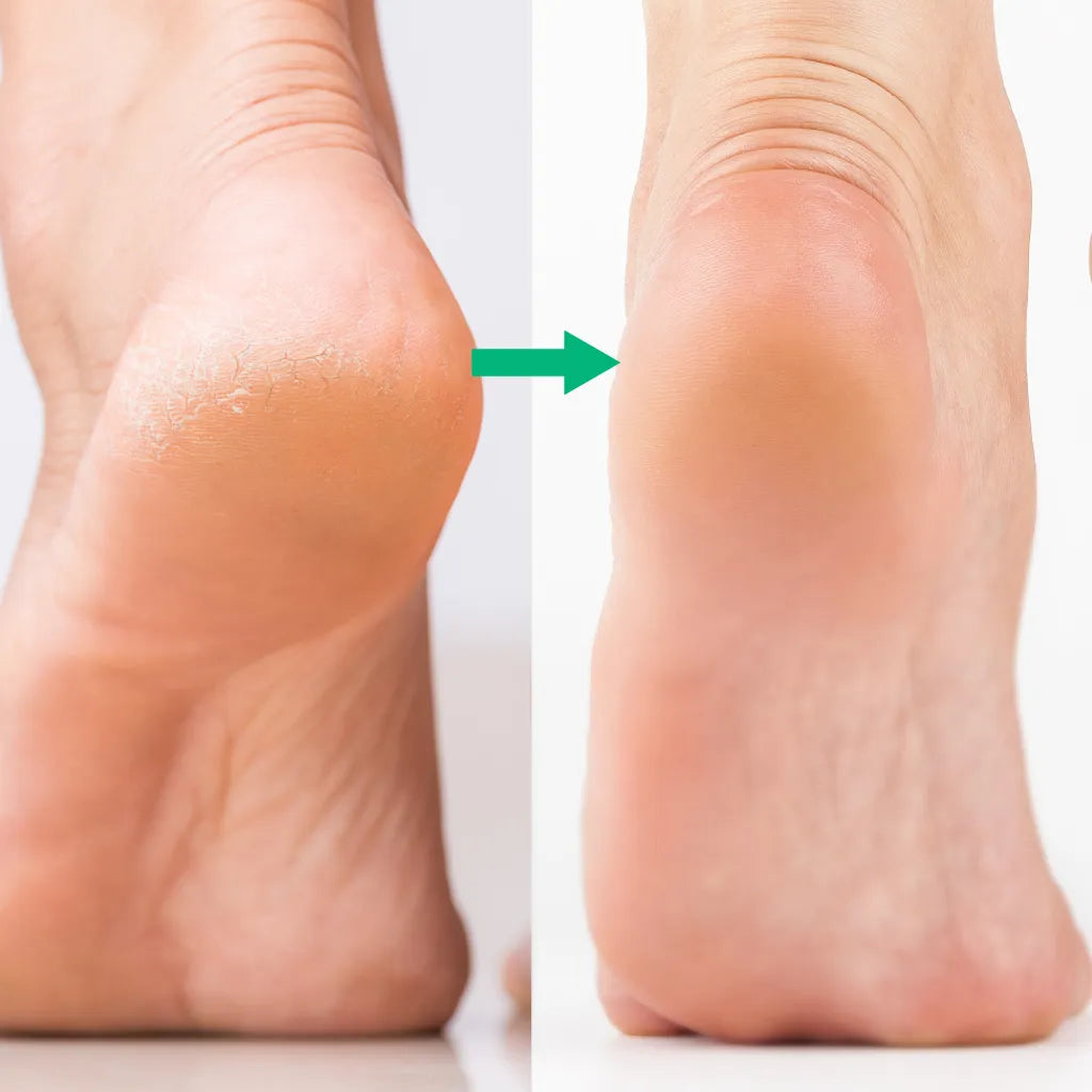 Râpe électrique pour pieds professionnelle Râpe à pied PODOWAYS