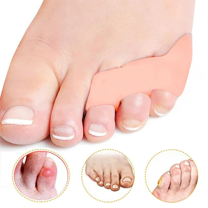 oignon pied petit orteil  Podoways   